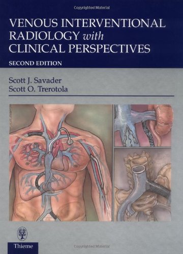 Venous Interventional Radiology with Clinical Perspectives