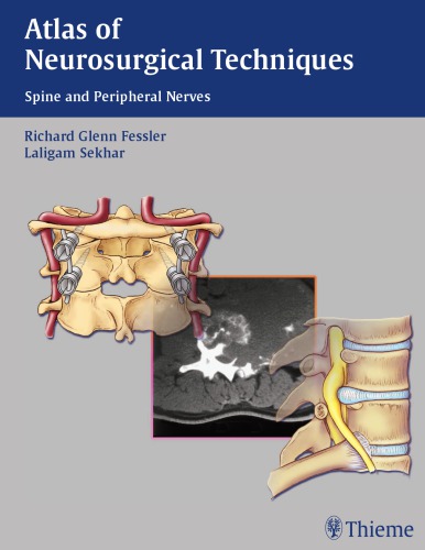 Atlas of Neurosurgical Techniques