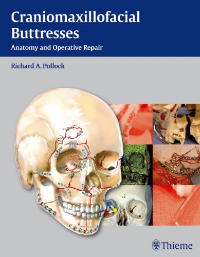 Craniomaxillofacial Buttresses