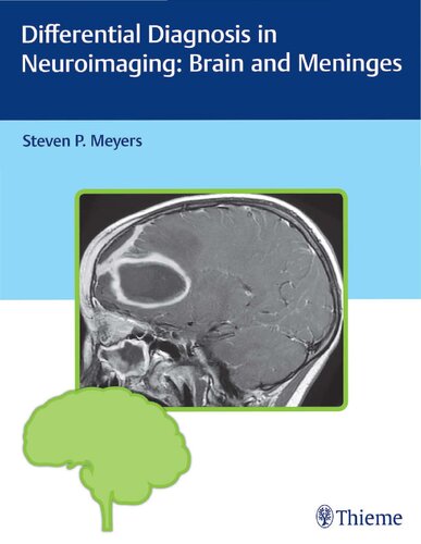 Differential diagnosis in neuroimaging. Brain and meninges