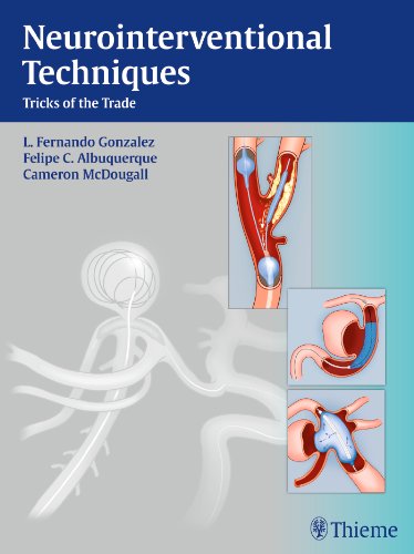 Neurointerventional Techniques