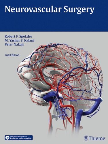 Neurovascular Surgery