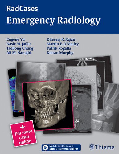 Radcases Emergency Radiology