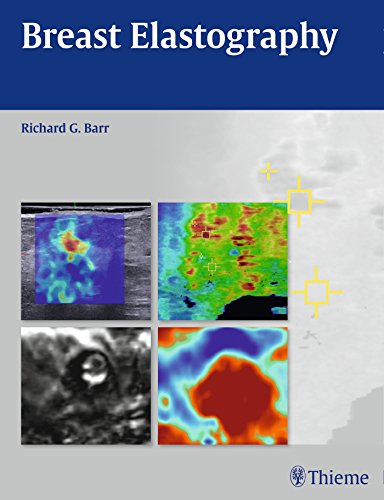 Breast elastography