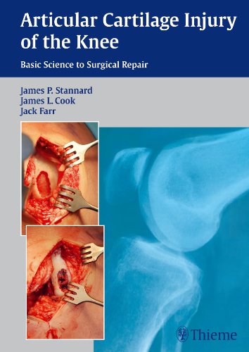 Articular Cartilage Injury of the Knee