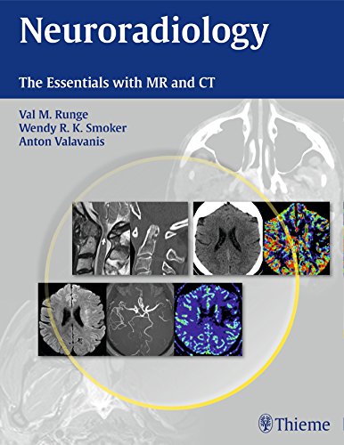 Neuroradiology