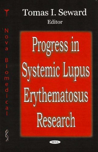 Progress in systemic lupus erythematosus research