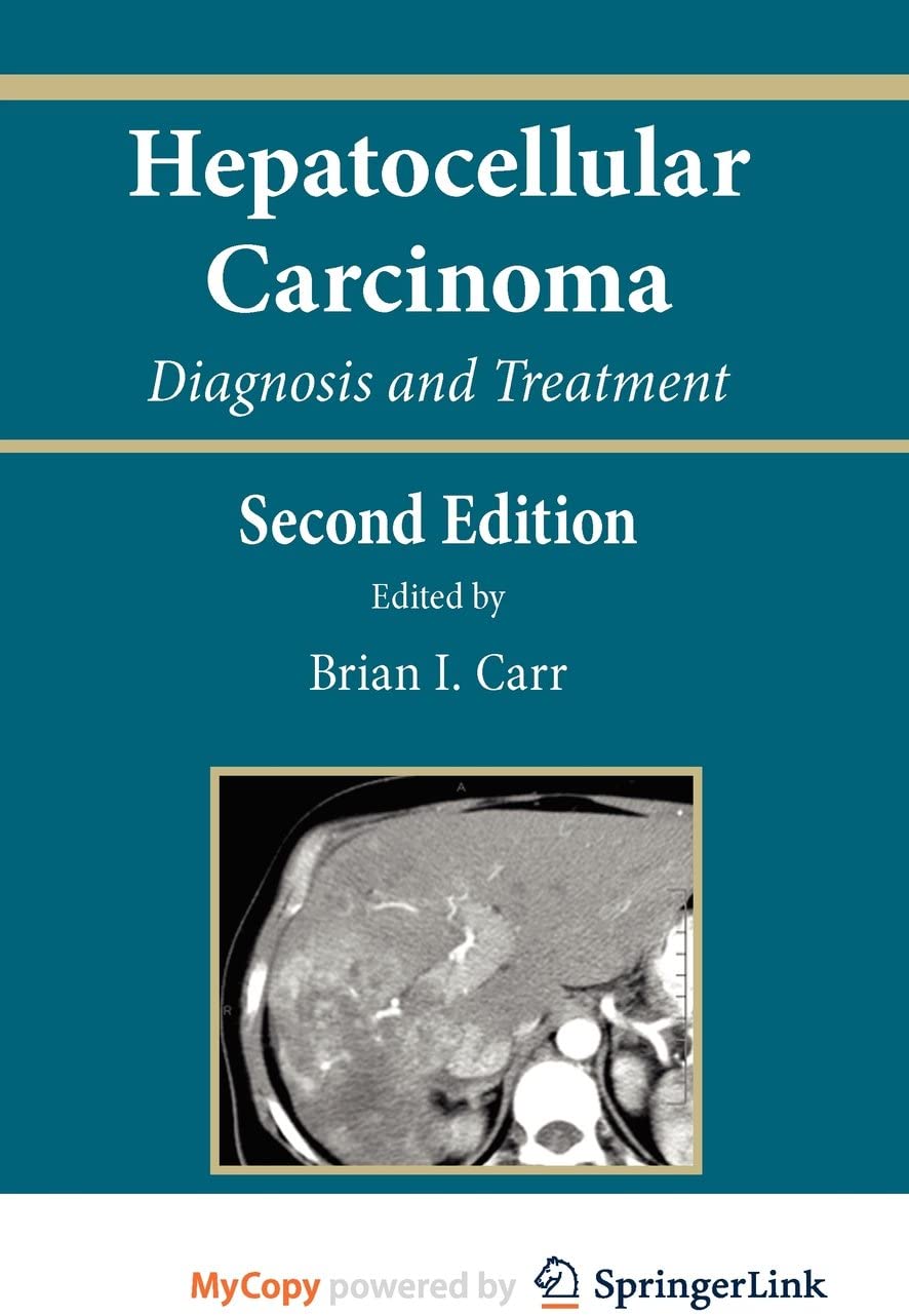 Hepatocellular Carcinoma: Diagnosis and Treatment