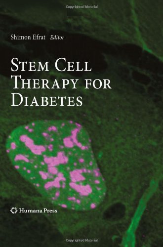 Stem Cell Therapy for Diabetes