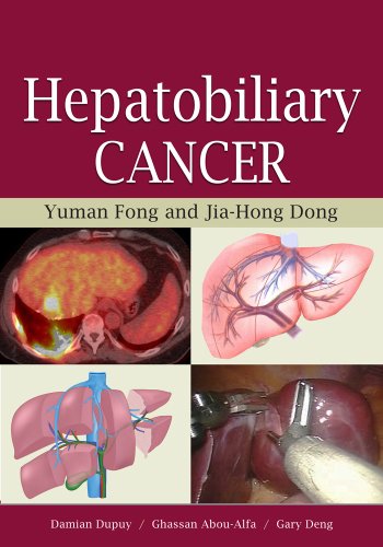 Hepatobiliary cancer