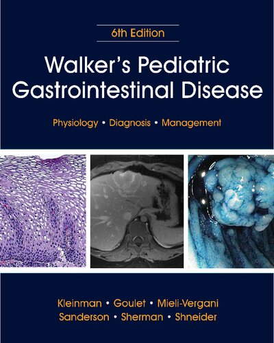 Walker's Pediatric Gastrointestinal Disease