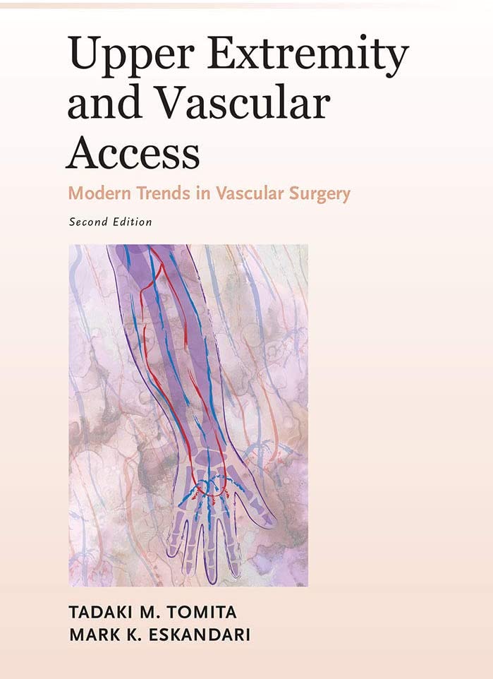 Upper Extremity and Vascular Access (Modern Trends in Vascular Surgery)