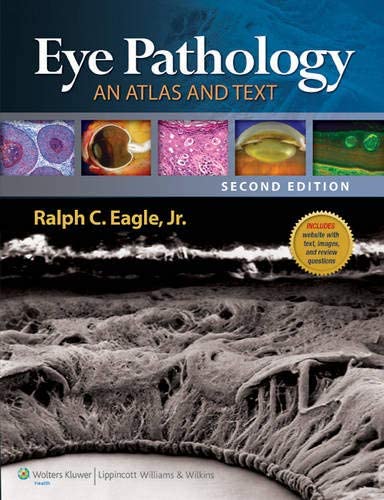 Eye Pathology