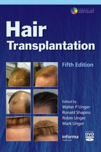 Hair Transplantation [with DVD]