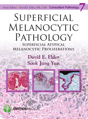 Superficial Melanocytic Pathology