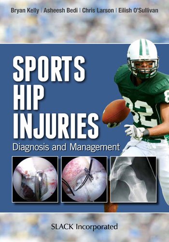 Sports Hip Injuries