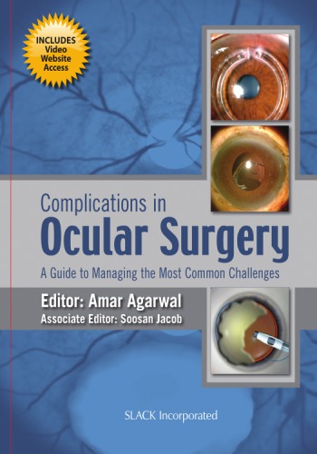 Complications in Ocular Surgery