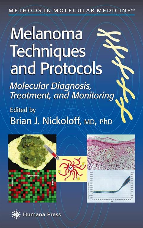 Melanoma Techniques and Protocols: Molecular Diagnosis, Treatment, and Monitoring (Methods in Molecular Medicine, 61)