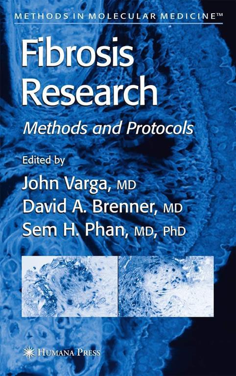 Fibrosis Research: Methods and Protocols (Methods in Molecular Medicine, 117)