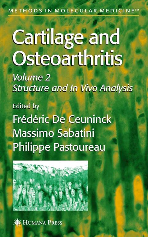 Cartilage and Osteoarthritis (Methods in Molecular Medicine, 101)