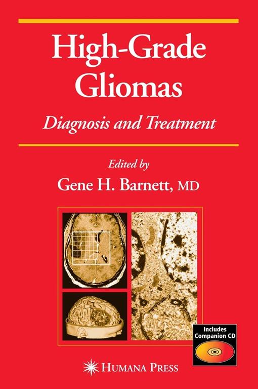 High-Grade Gliomas: Diagnosis and Treatment (Current Clinical Oncology)