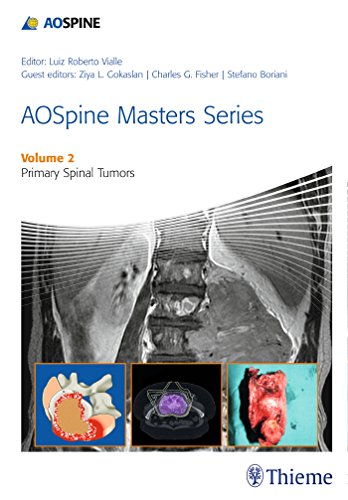Primary spinal tumors