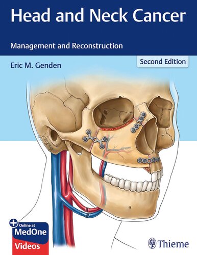 Head and Neck Cancer: Management and Reconstruction