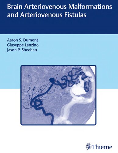 Brain arteriovenous malformations and arteriovenous fistulas