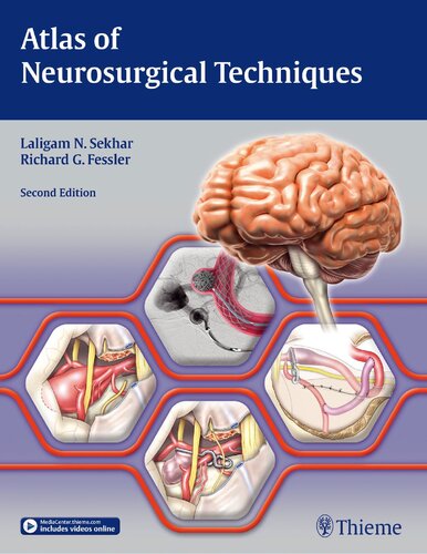 Atlas of Neurosurgical Techniques