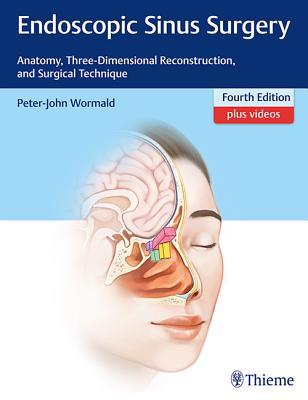 Endoscopic Sinus Surgery