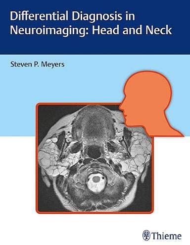 Differential Diagnosis in Neuroimaging