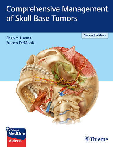 Comprehensive Management of Skull Base Tumors