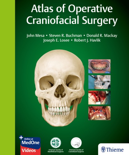 Atlas of Operative Craniofacial Surgery