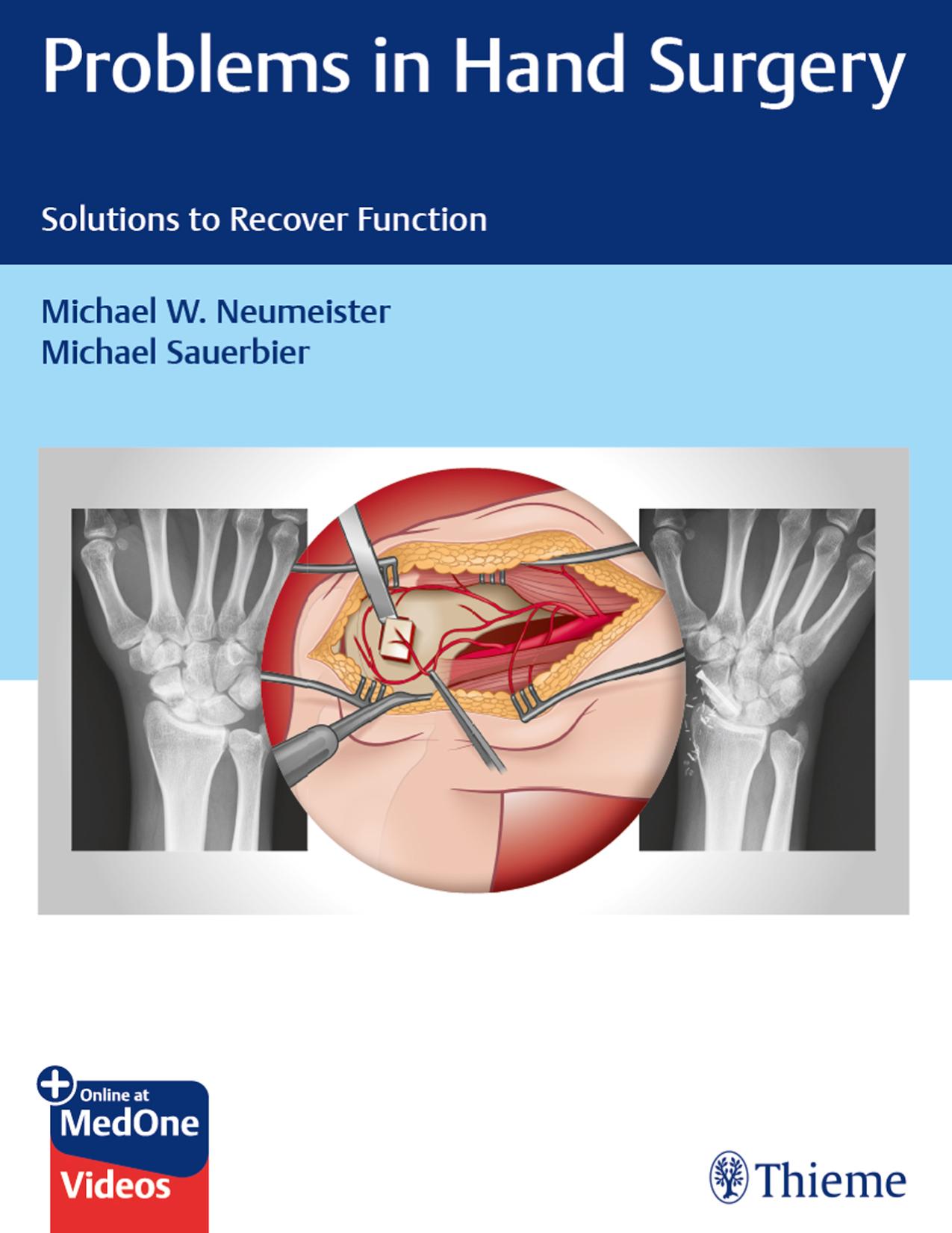 Problems in Hand Surgery