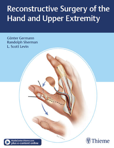 Reconstructive surgery of the hand and upper extremity