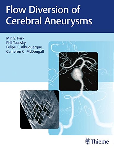 Flow Diversion of Cerebral Aneurysms