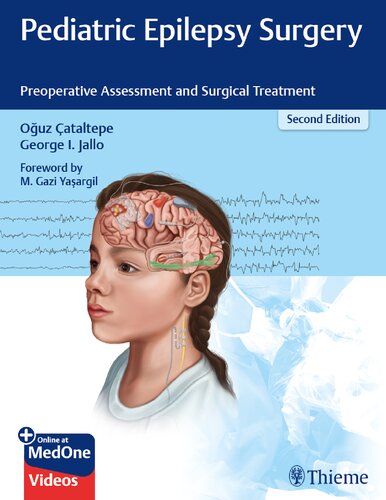 Pediatric Epilepsy Surgery