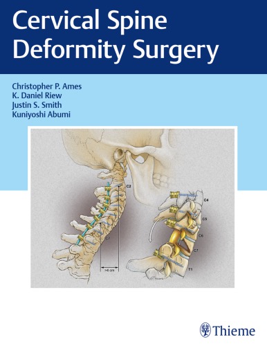 Cervical Spine Deformity Surgery