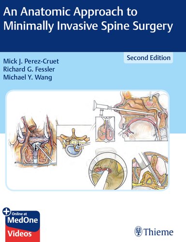 An Anatomic Approach to Minimally Invasive Spine Surgery