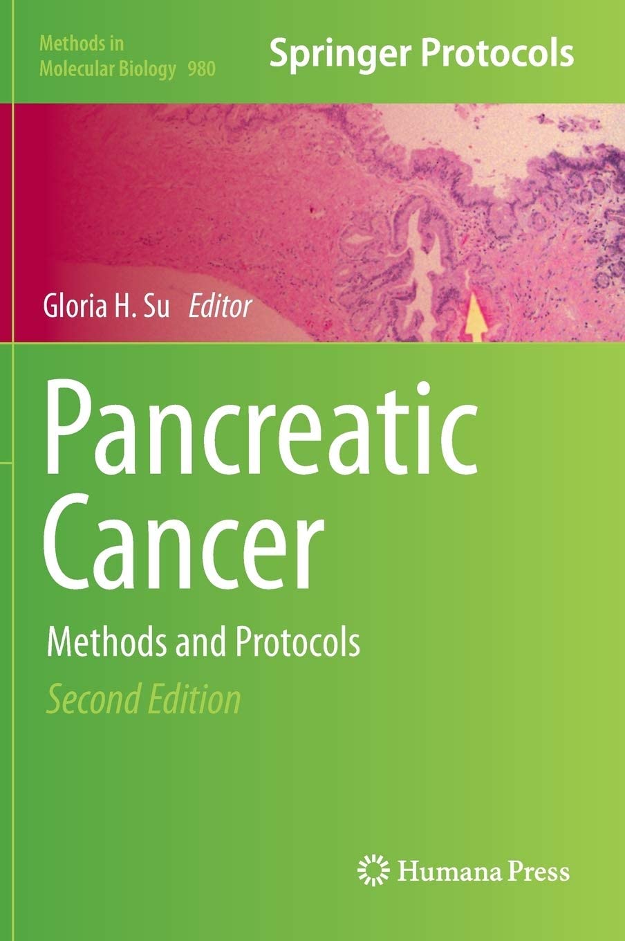 Pancreatic Cancer