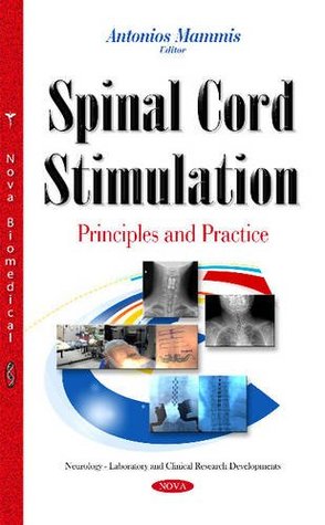 Spinal Cord Stimulation