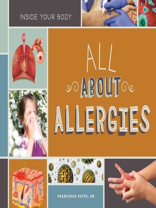 All About Allergies