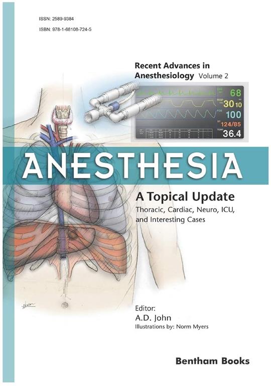 Anesthesia