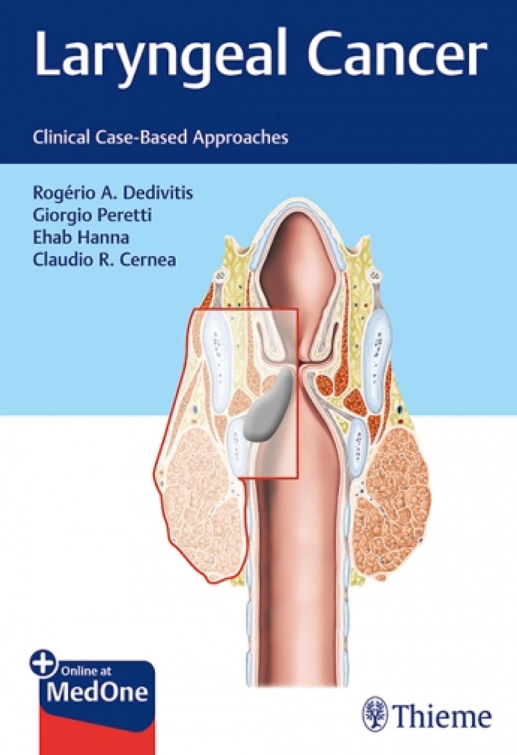 Laryngeal Cancer