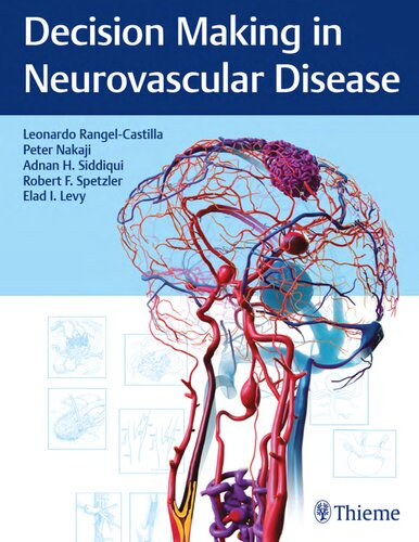 Decision Making in Neurovascular Disease