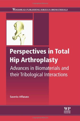 Perspectives in total hip arthroplasty