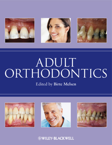 Adult orthodontics