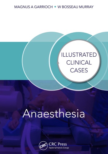 Anaesthesia