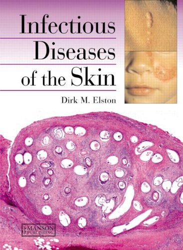 Infectious Diseases Of The Skin