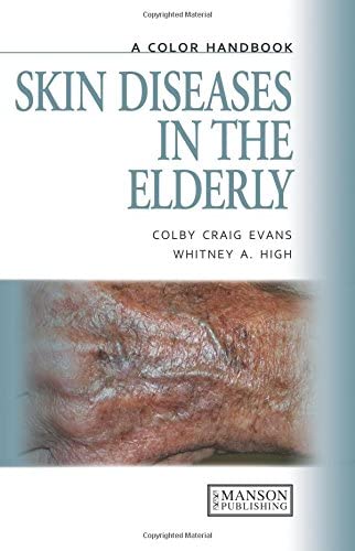 Skin Diseases in the Elderly